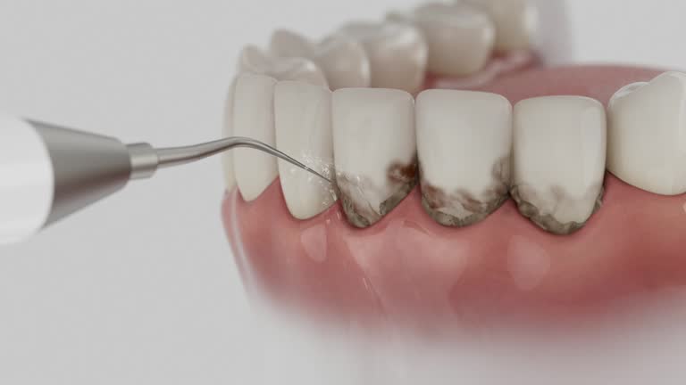 Reliable Dental contractor in Big Coppitt Key, FL by Dentist Open Now